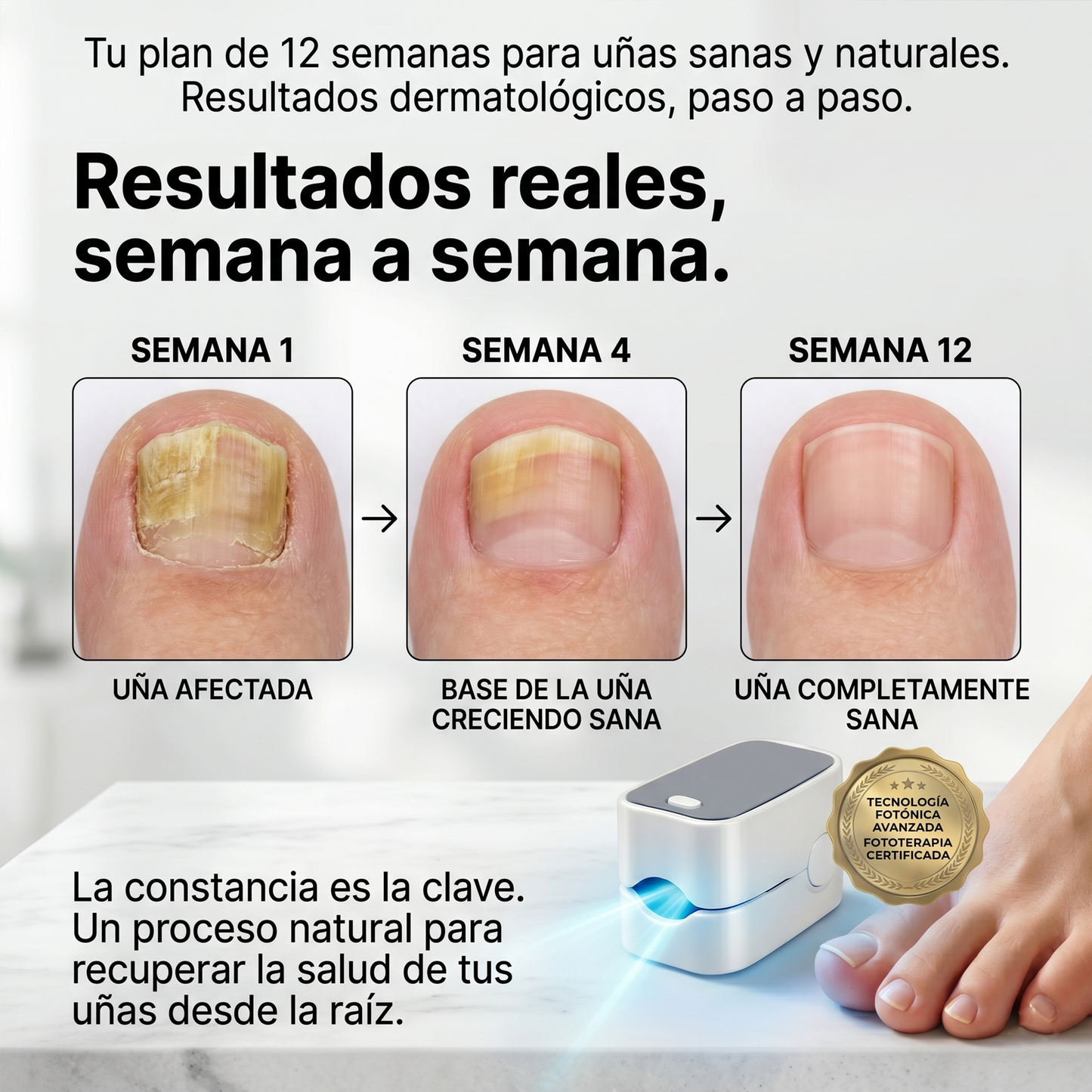 LIBERANAIL™ LED - LASER LED PARA LOS HONGOS DE LAS UÑAS