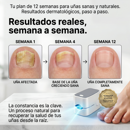 LIBERANAIL™ LED - LASER LED PARA LOS HONGOS DE LAS UÑAS